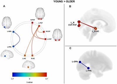 Age-Related Differences in Functional and Structural Connectivity in the Spatial Navigation Brain Network